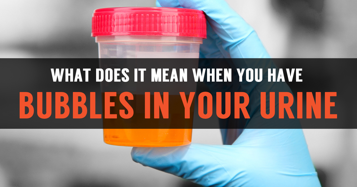 what cause bubbles in urine
