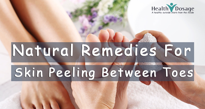 natural remedies for skin peeling toes