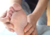 Skin Peeling Between Toes: Causes & Treatment skin peeling between toes