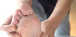 Skin Peeling Between Toes: Causes & Treatment skin peeling between toes