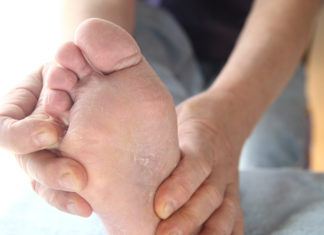 skin peeling between toes