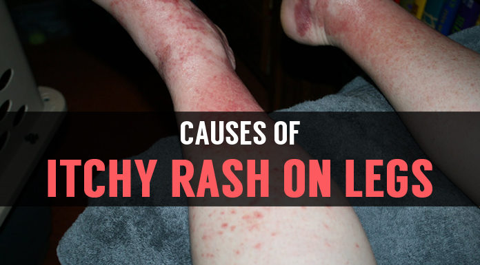 causes of itchy rash on legs