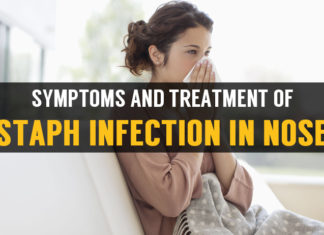 Staph Infection In Nose: Symptoms and Treatment symptoms and treatment staph infection in nose