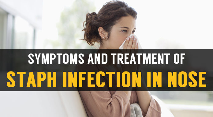 Staph Infection In Nose: Symptoms and Treatment symptoms and treatment staph infection in nose