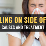 causes and treatment of swelling on side of nose