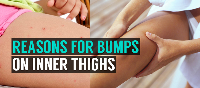 how to get rid of chafing bumps on inner thighs