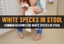 common reasons for white specks in stool