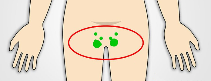 Learn Reasons for Lower Inner Thigh Pain and Cure