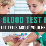 MPV or mean platelet volume blood test process