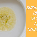 bubbles in urin causes and treatment