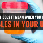 bubbles in urine male and female
