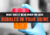 Bubbles in Urine: Symptoms & Causes bubbles in your urine