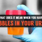 bubbles in your urine