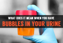 Bubbles in Urine: Symptoms & Causes bubbles in your urine