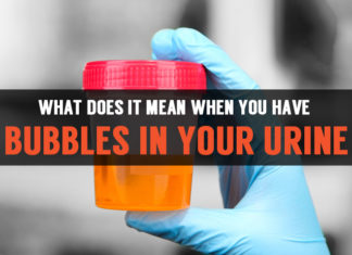 bubbles in your urine