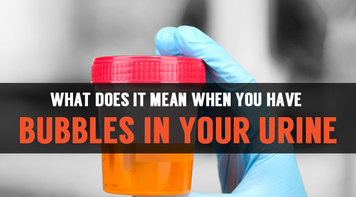 Bubbles in Urine: Symptoms & Causes bubbles in your urine