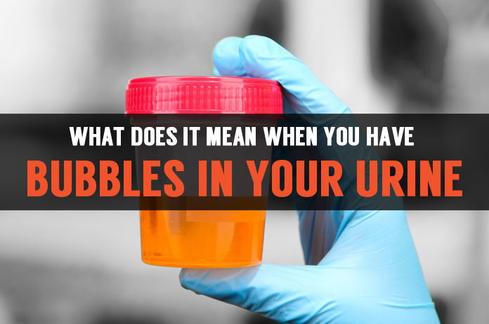 bubbles in your urine