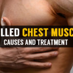 causes and treatment for pulled chest muscle