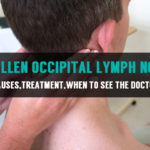 causes treatment of swollen occipital lymph nodes