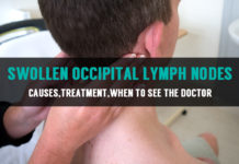 causes treatment of swollen occipital lymph nodes