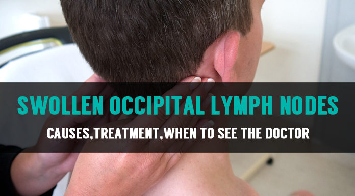causes treatment of swollen occipital lymph nodes