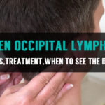 know about swollen occipital lymph nodes