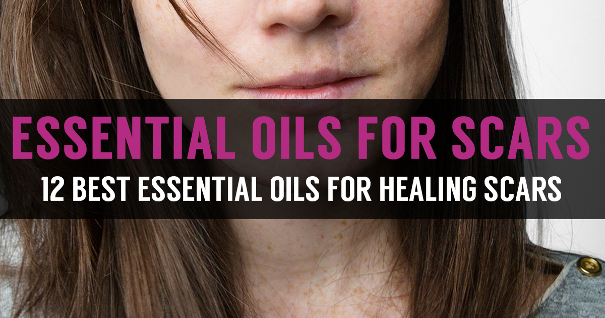 List Of Essential Oils For Scars And Learn Reducing Scars