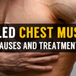 symptoms and treatment of pulled chest muscle