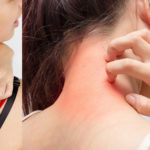 causes of skin itching