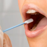 remedies for sore on roof of the mouth