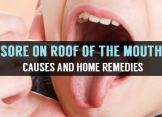 What is Roof of the Mouth Sores? Causes and Home Remedies sore on roof of the mouth causes and home remedies