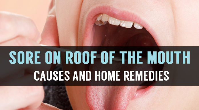 sore on roof of the mouth causes and home remedies