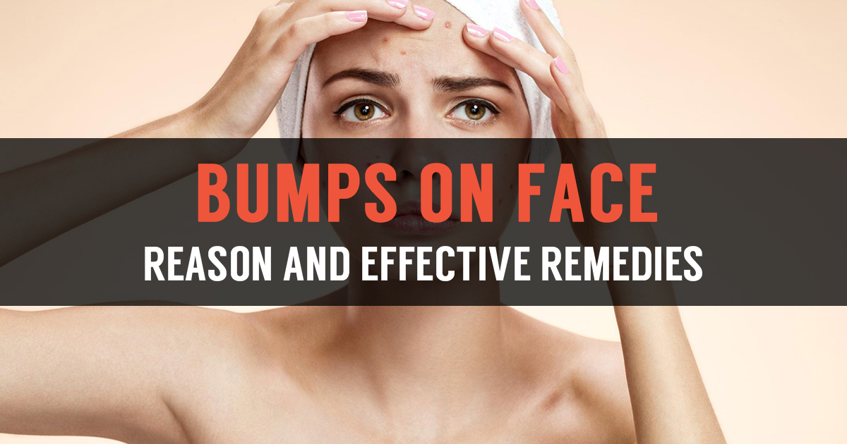 Do You Have Small Bumps On Your Face Learn Effective Treatment