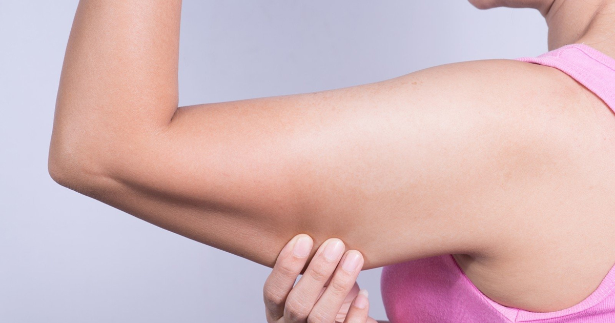 How to Get Rid of Arm Fat and Best Exercises for Flabby Arms