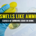 what to do if pee smells like ammonia