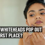 why do whiteheads pop out in the first place