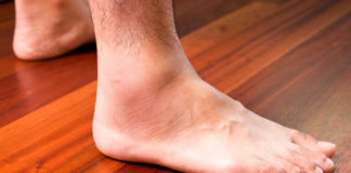 Hair Loss On Legs: The Rare Problem hair loss on legs