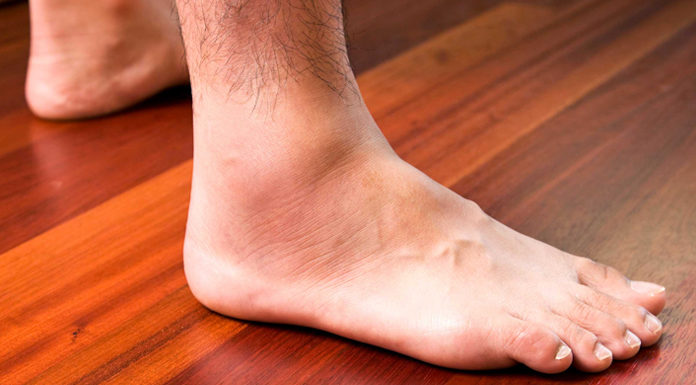 Hair Loss On Legs: The Rare Problem hair loss on legs