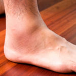 what causes hair loss on the legs