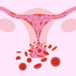 homegrown remedies to get menstrual periods