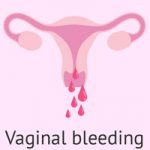 vaginal bleeding or spotting