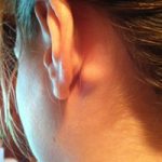 lymph node behind ear