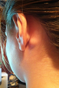swollen lymph nodes behind ear