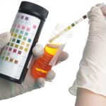 urine color diagnosis and treatment