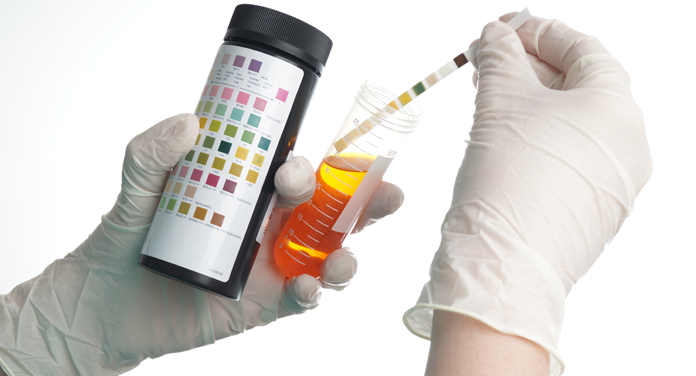 urine color diagnosis and treatment