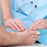 how to get rid of bunions