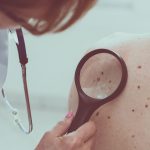 skin cancer symptoms types pictures and spots