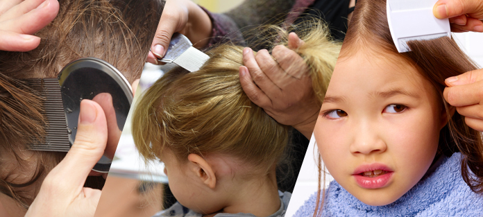 treat and prevent head lice in kids