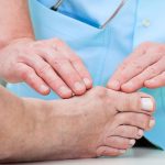 ways to get rid of bunions fast and naturally