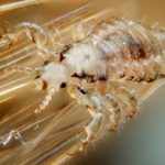 what is head lice